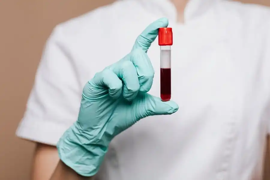 Blood Sample Collection