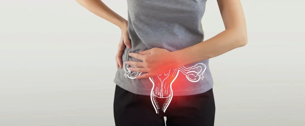 PCOS