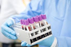 Biochemistry pathology tests