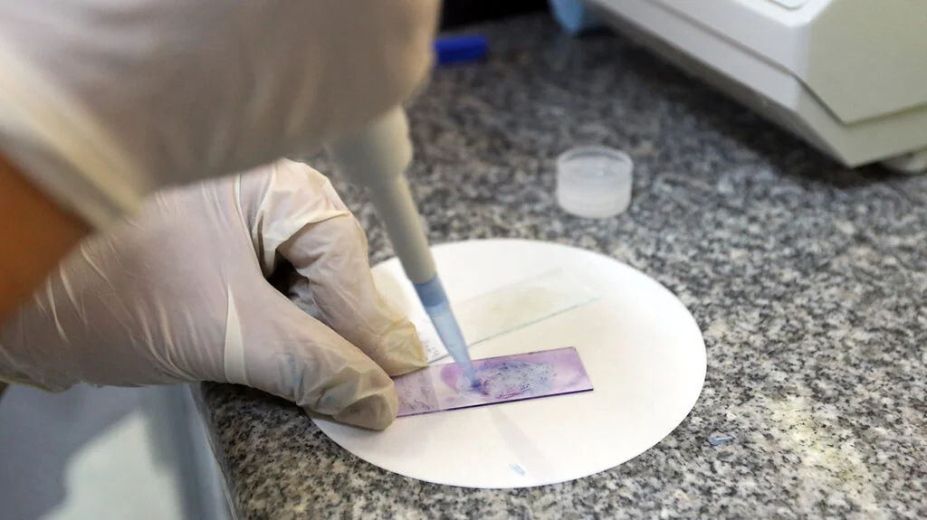 Biopsy and Histopathology Analysis